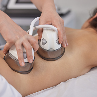 a beautician using a cupping machine for an anti-cellulite procedure
