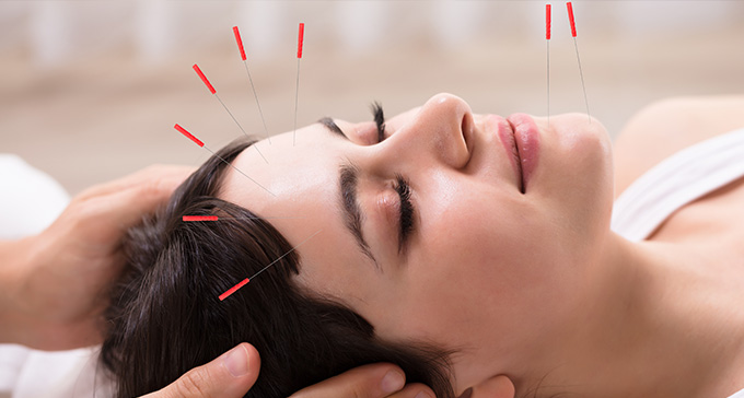 a woman relaxing while receiving a facial acupuncture treatment with red-tipped needles 